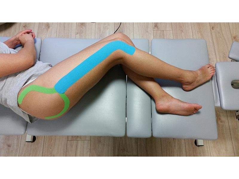 Kinesiotaping w przypadku zespołu pasma biodrowo-piszczelowego u biegaczy.