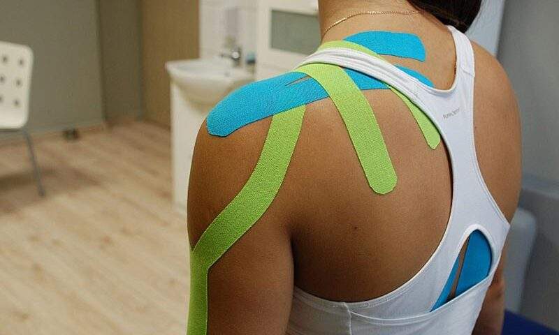 Kinesiotaping zastosowany na zespół bolesnego barku.