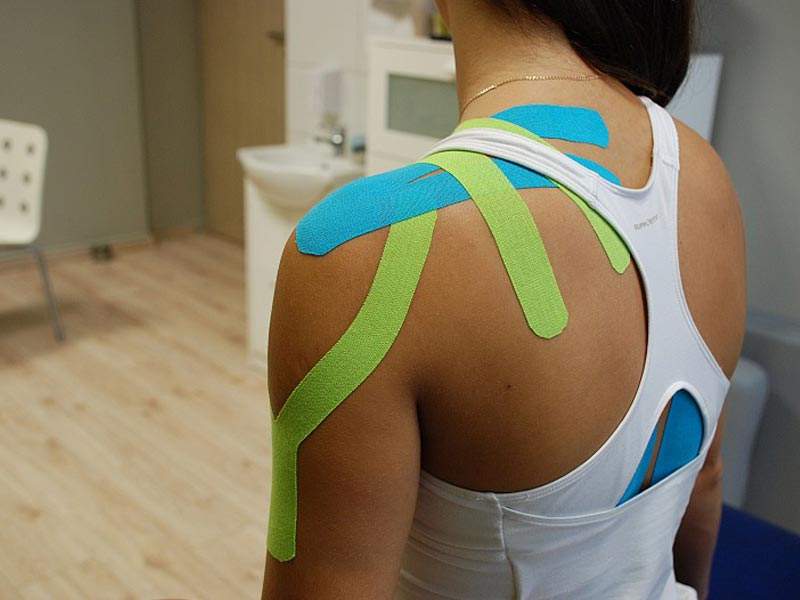 Kinesiotaping zastosowany na zespół bolesnego barku.