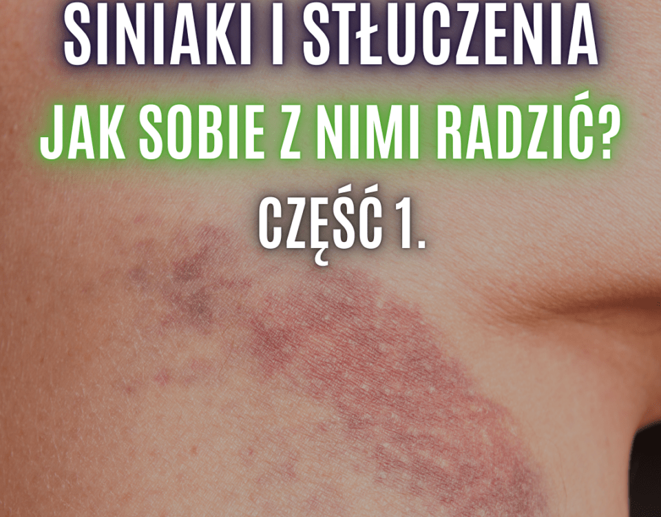 stłuczenia