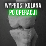 wyprost stawu kolanowego