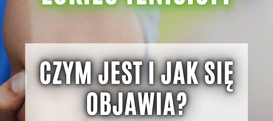 łokieć tenisisty objawy