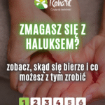 haluksy leczenie zachowawcze