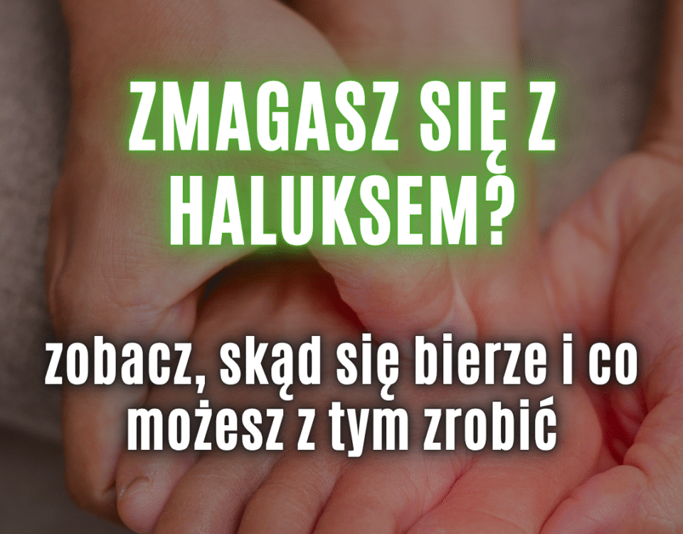 haluksy leczenie zachowawcze