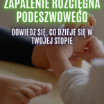 zapalenie rozcięgna podeszwowego