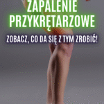 zapalenie przykrętarzowe biodra