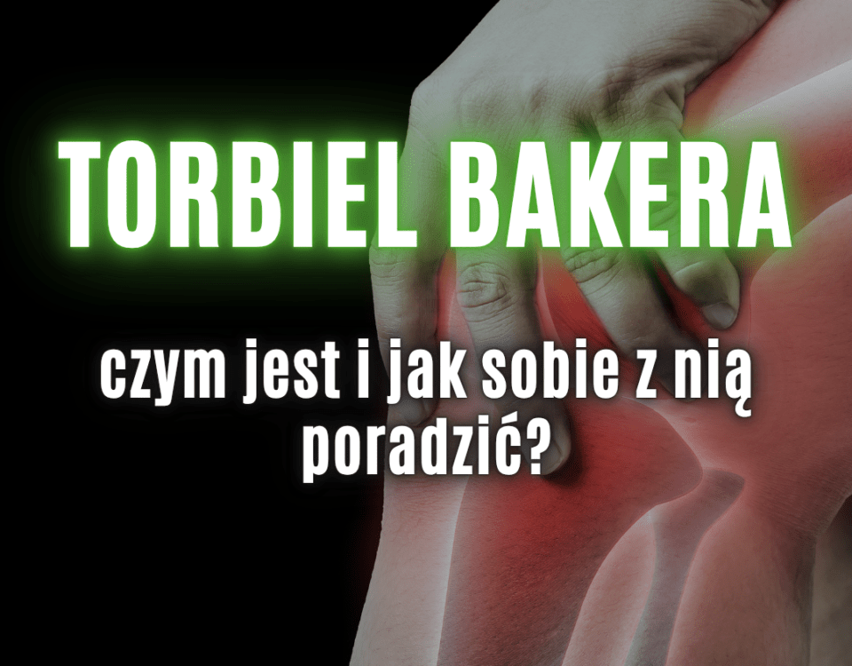 torbiel Bakera