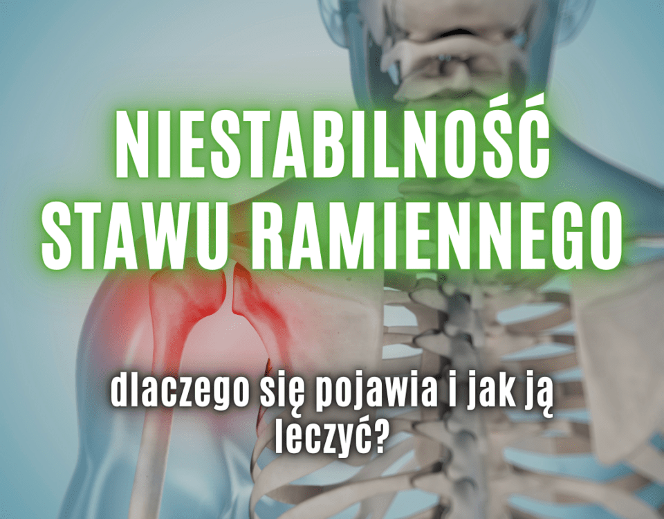 niestabilność stawu ramiennego