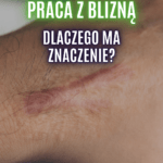 praca z blizną